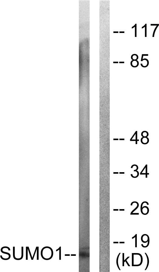 IHC-plus™ Polyclonal Rabbit anti-Human SUMO1 / SMT3 Antibody (aa1-50, IHC, IF, WB)