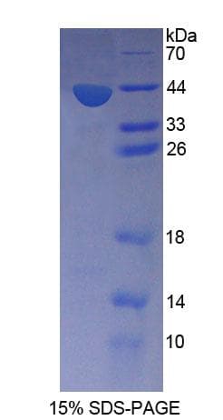 Mouse SNUPN Protein (Recombinant His-T7)