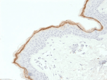 FLG / Filaggrin Antibody (clone FLG/1563)