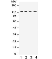 UBA1 / UBE1 Antibody
