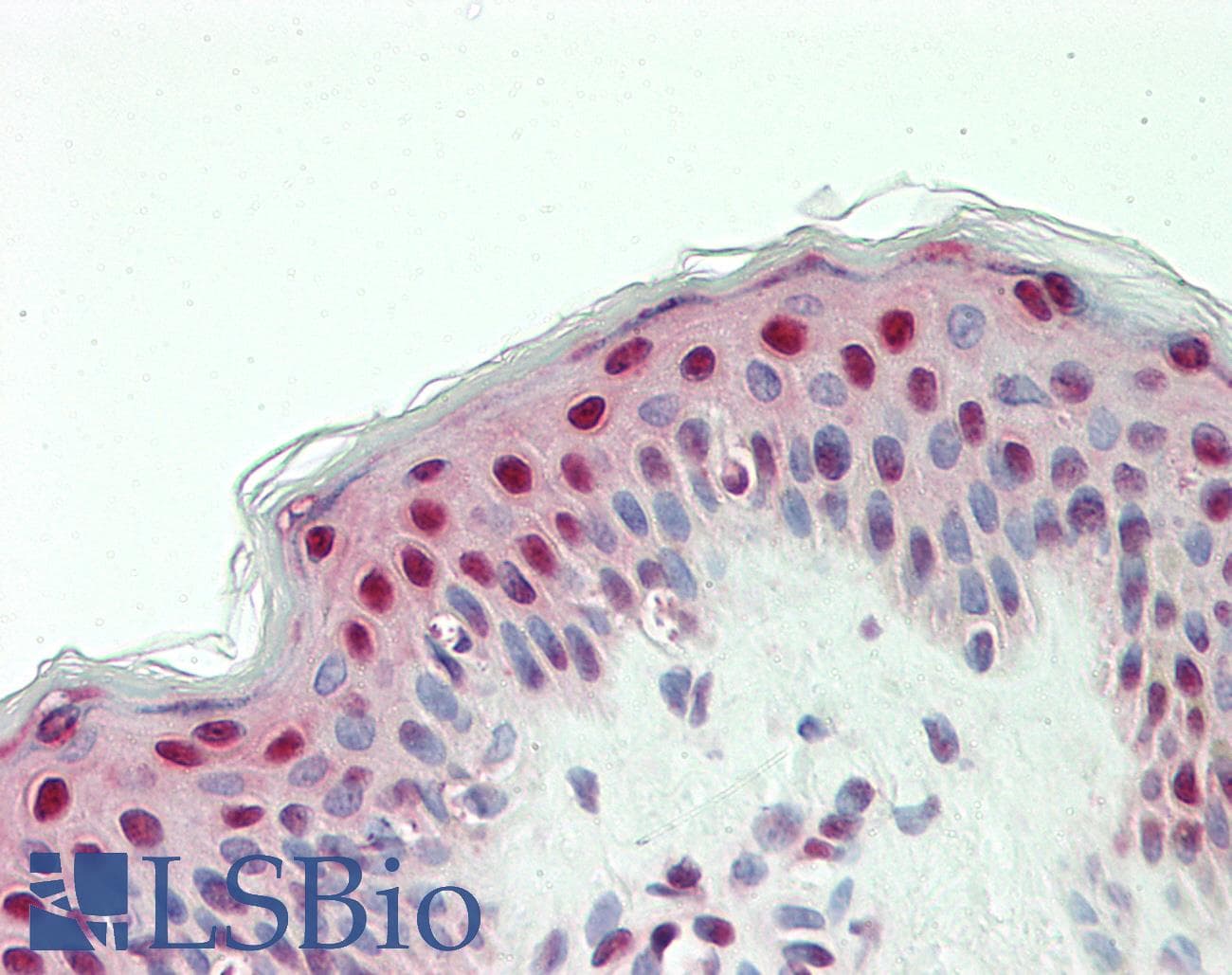SNRPD2 Antibody (HRP)