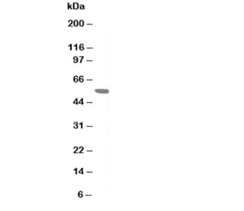 CHRNA1 Antibody (aa22-36)