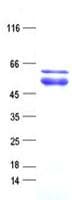 Human ZNF641 Protein (Recombinant His, N-Terminal)