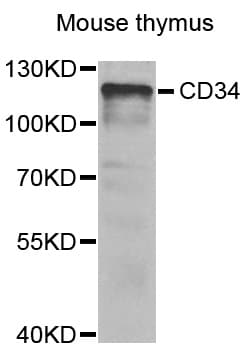 IHC-plus™ Polyclonal Rabbit anti-Human CD34 Antibody (IHC, IF, WB)