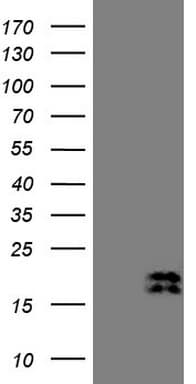 NPPB / BNP Antibody (aa27-102, clone OTI17A6)