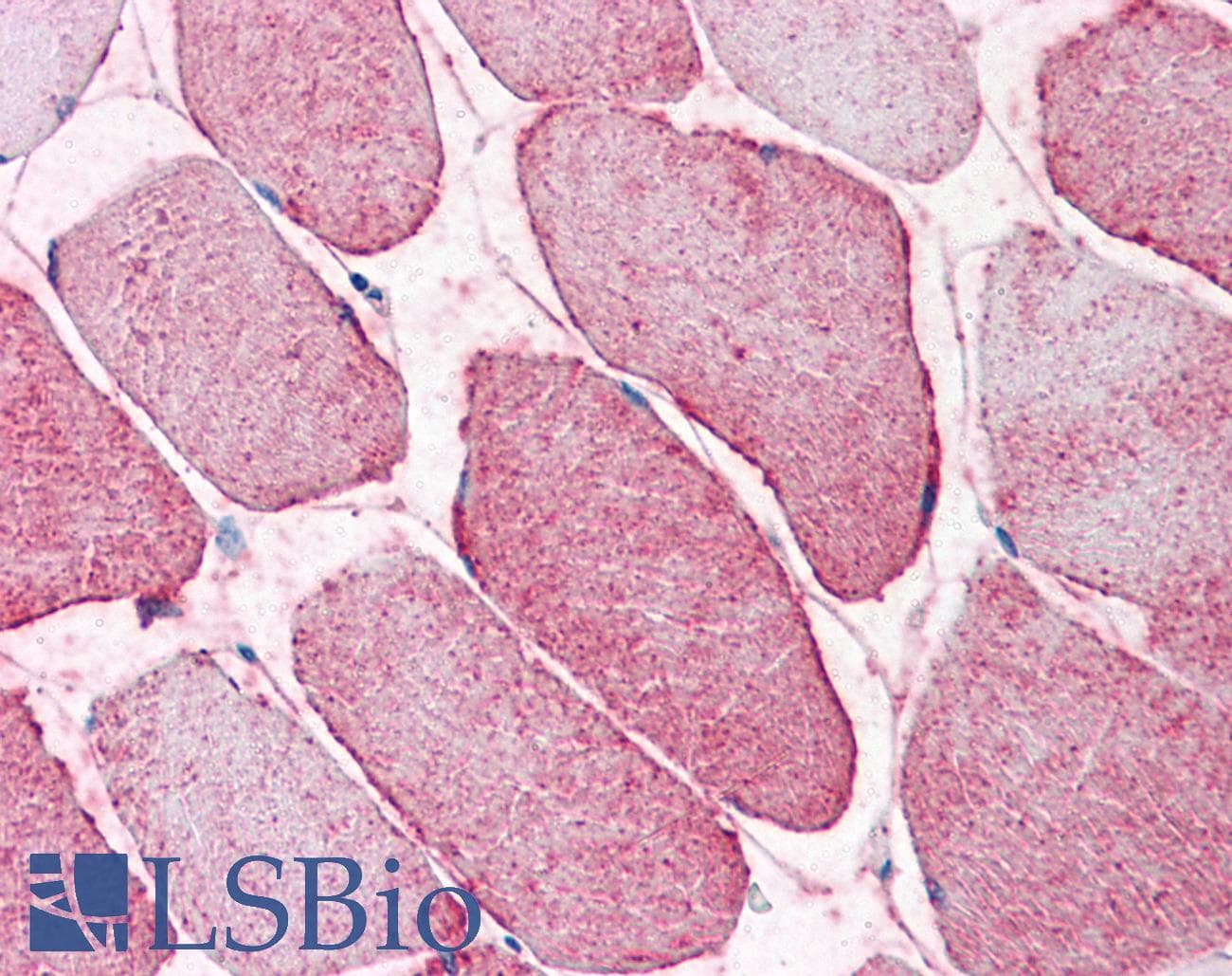 IHC-plus™ SEMA4B / Semaphorin 4B Antibody (N-Terminus)