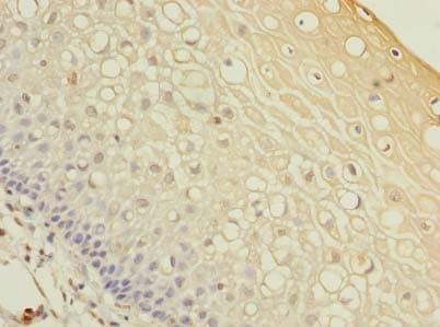 MRPL48 Antibody