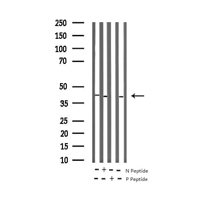 Polyclonal Rabbit anti-Human MAPK14 / p38 Antibody (phospho-Tyr323, IHC, IF, WB)