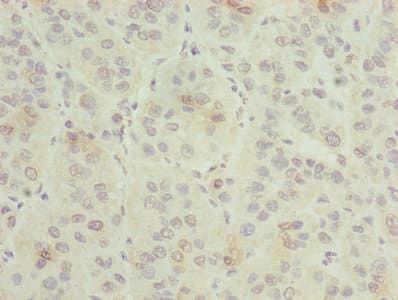 Polyclonal Rabbit anti-Human GNG5 Antibody (IHC)