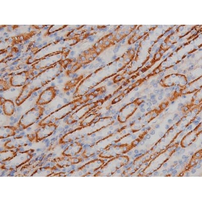 SNCA / Alpha-Synuclein Antibody (phospho-Ser129)