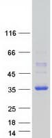 Human DNAJC12 Protein (Recombinant Myc-DDK (Flag))
