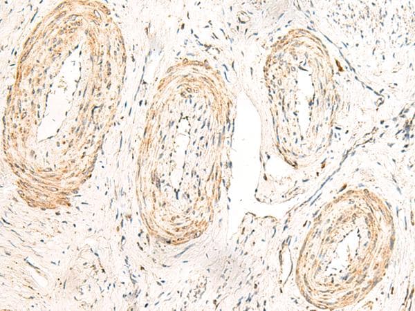 GPR160 Antibody