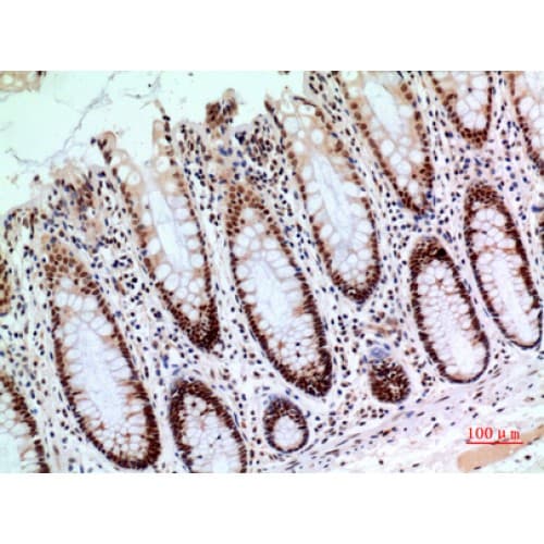 Polyclonal Rabbit anti-Human HIF2A / EPAS1 Antibody (380-420 aa, IHC, IF, WB)