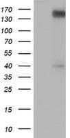 ERBB2 / HER2 Antibody (aa676-1255, clone OTI3F11, Carrier-free)