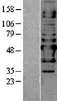 NAPRT Protein (Over-Expression Lysate Myc-DDK (Flag))