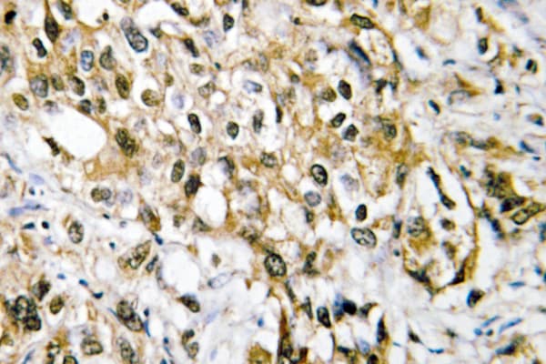 MYC / c-Myc Antibody (Lys422)