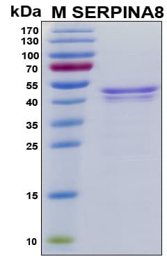 Human AGT / Angiotensinogen Protein (Recombinant His, N-Terminal)