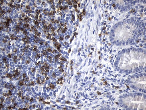 Monoclonal Mouse anti-Human CD8A / CD8 Alpha Antibody (clone UMAB241, aa22-182, IHC)