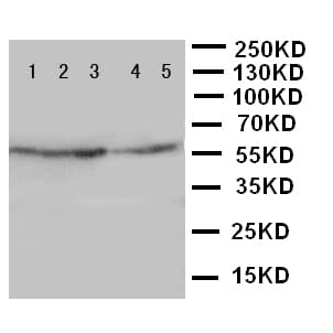 Polyclonal Rabbit anti-Human IDS / Iduronate 2 Sulfatase Antibody (aa430-448, IHC, WB)