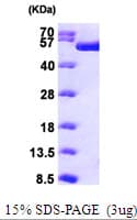 Human TIP49 / RUVBL1 Protein (Recombinant His)