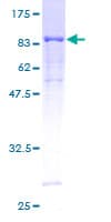 Human STK3 Protein (Recombinant GST)