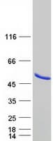 Human METAP1 Protein (Recombinant Myc-DDK (Flag))