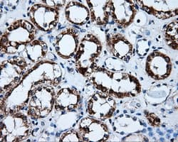 HSD17B10 / HADH2 Antibody (clone OTI10B4)