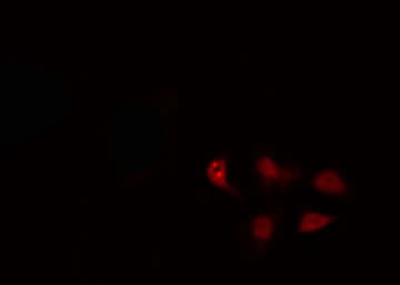 Polyclonal Rabbit anti-Human ZNF397 Antibody (IF, WB)