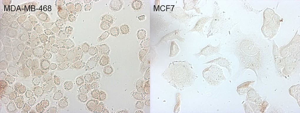 p16INK4a / CDKN2A Antibody (clone OTI5H8)