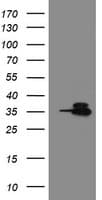 OTUB1 / OTU1 Antibody (clone OTI5B8)