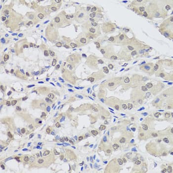 Polyclonal Rabbit anti-Human AGO2 / EIF2C2 Antibody (IHC, WB)