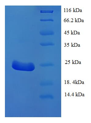 Mouse DEC-205 / CD205 / LY75 Protein (Recombinant 6His, N-terminus)