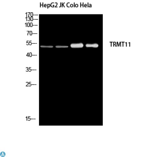 Polyclonal Rabbit anti-Human TRMT11 Antibody (WB)