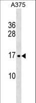SRP14 Antibody (aa28-55)