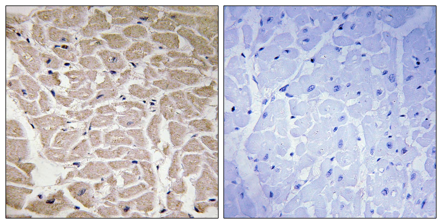 COL16A1 Antibody (aa1121-1170)