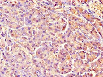 Polyclonal Rabbit anti-Human REG1A Antibody