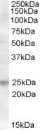 IHC-plus™ FAIM Antibody (aa121-132)