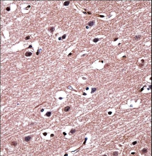 RORB / ROR Beta Antibody (aa329-358)