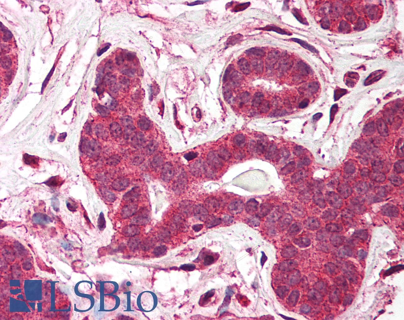 IHC-plus™ TP1 / TEP1 Antibody