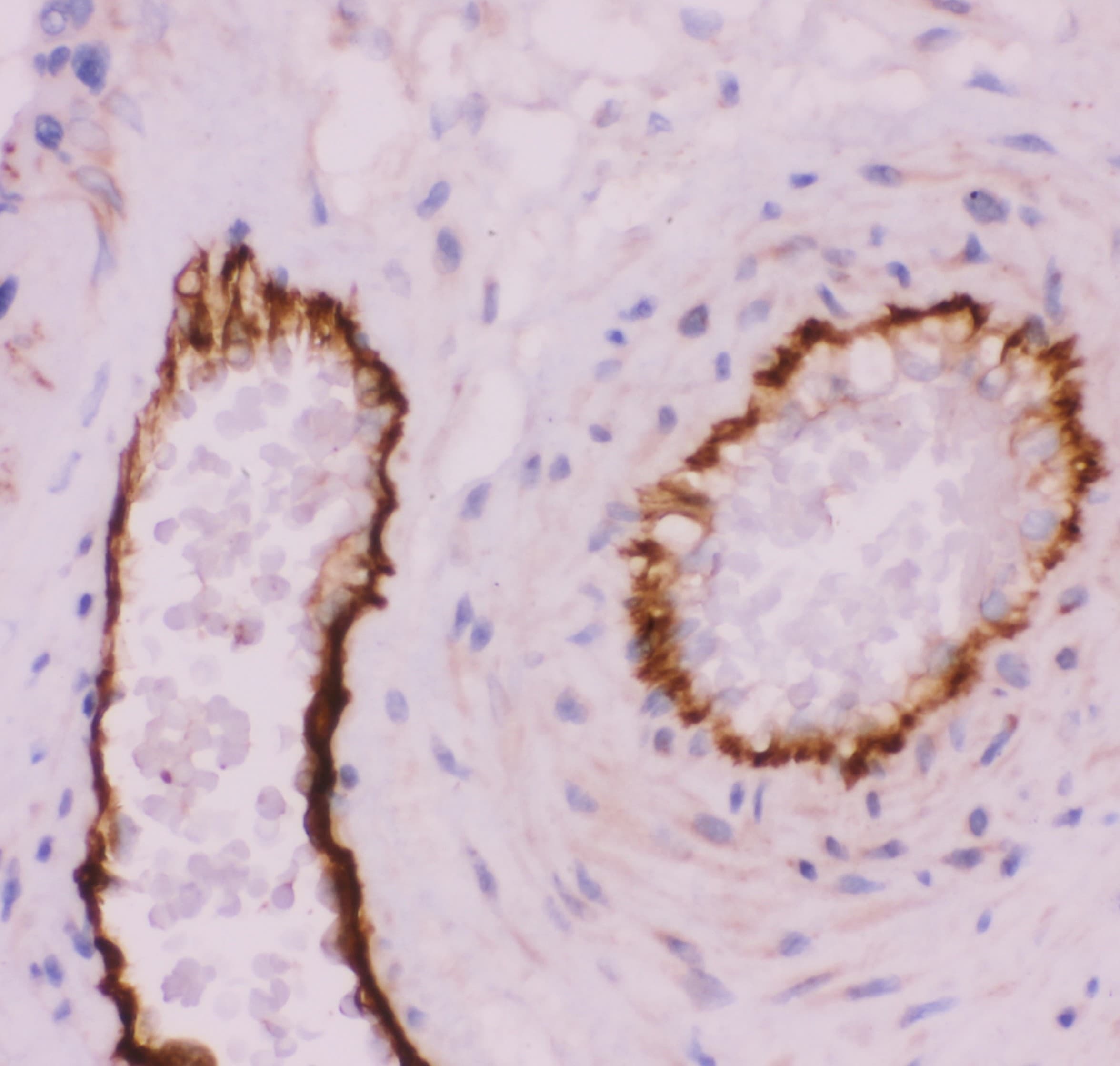 Polyclonal Rabbit anti-Human PECAM-1 / CD31 Antibody (aa28-382, IHC, WB)