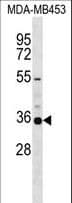 Polyclonal Rabbit anti-Human KCNA5 / Kv1.5 Antibody (aa508-536, WB)