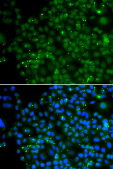ZNF187 Antibody