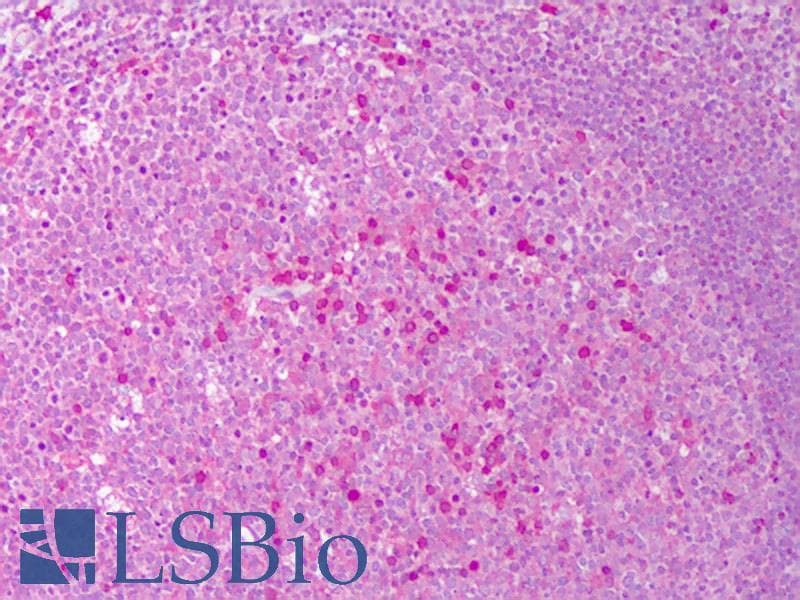 PathPlus™ Polyclonal Rabbit anti-Human IL6 / Interleukin 6 Antibody (IHC, WB)