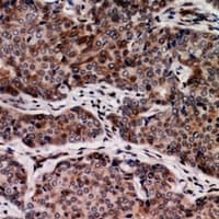 DKK3 Antibody