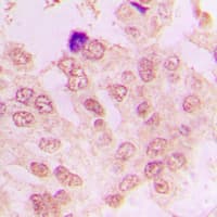 CCNA1/CCNA2 Antibody (Internal)