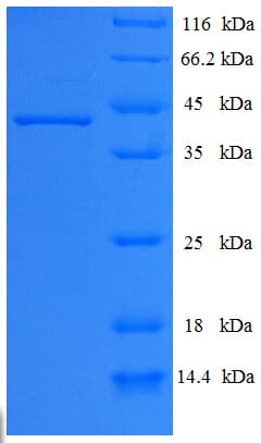 Human CELA3A / ELA3 Protein (Recombinant His-SUMO)