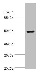 Polyclonal Rabbit anti-Human CKMT2 Antibody (aa40-230, IHC, WB)