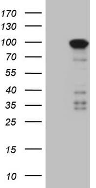 C-TAK1 / MARK3 Antibody (aa473-729, clone OTI3D8)