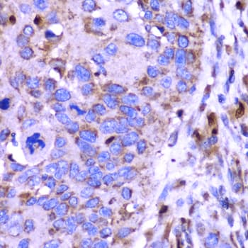 Polyclonal Rabbit anti-Human Osteonectin / SPARC Antibody (IHC, WB)