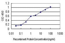 RARB / RAR Beta Antibody (clone 1F7)